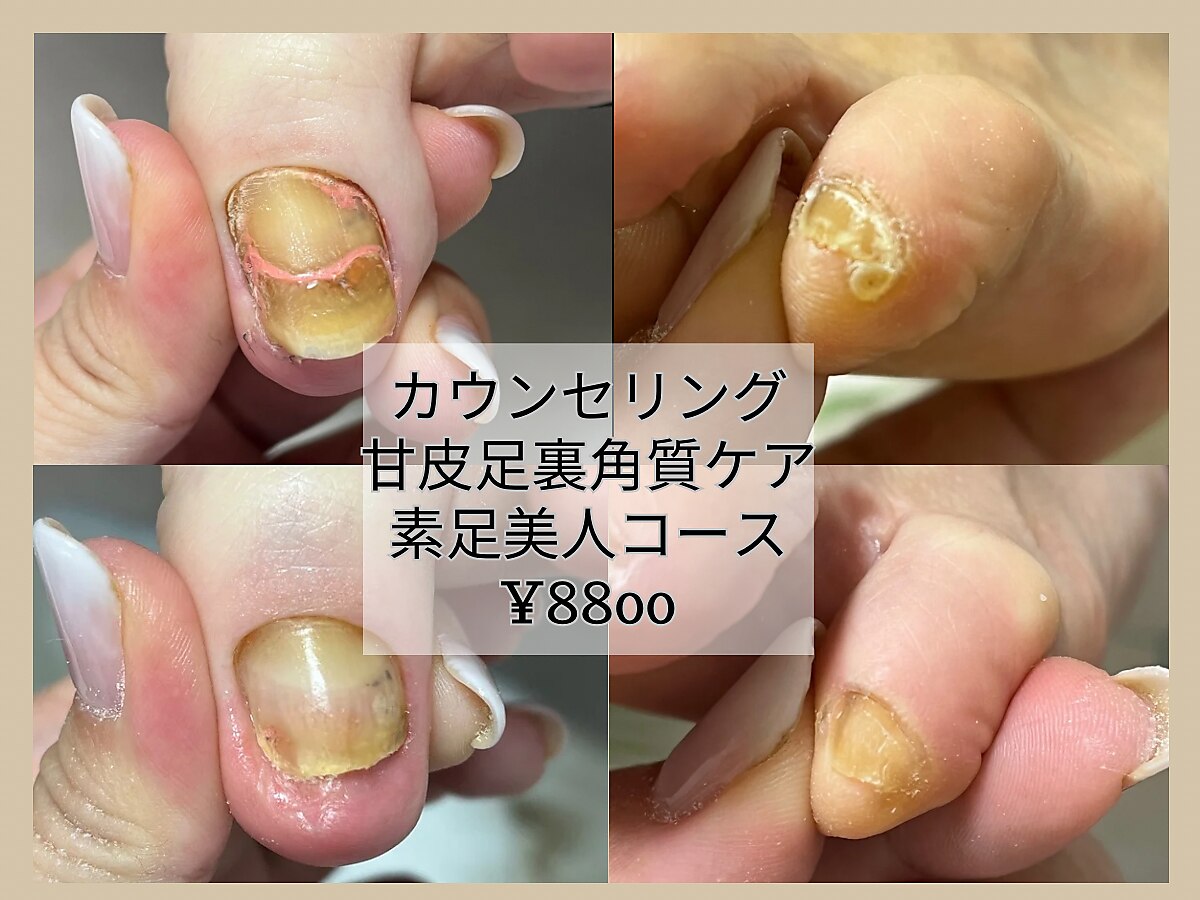 爪屋 爪屋｜ホットペッパービューティー