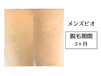 メンズビオ 神戸三宮店/