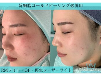 リメイククリニカルビューティー(Remake clinical beauty)/