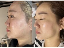 アプロディタの雰囲気（肌悩みの解決も得意♪一人一人に合った的確なアドバイス♪）