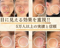 コハル(KOHARU)
