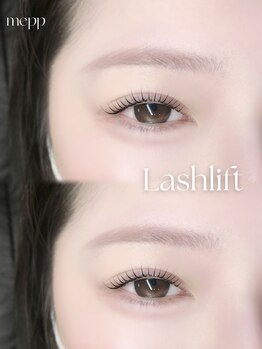 ミイプ(MEPP)/つねいし担当ラッシュリフト