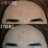 奏美