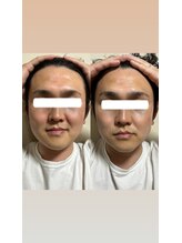 カシェット(cachette)/男性にも人気アルファワン