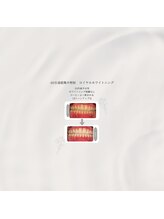 プラスビーセルフ(+b self)/ホワイトニングビフォーアフター