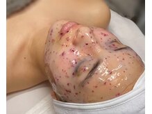 アリー(ALLY)/ハイドロジェリーマスク