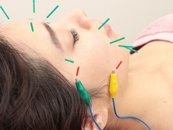 サーズ(SA’S)の写真/完全個室×女性鍼灸師のオーダーメイド施術で、肩こり・疲労を根本改善。美容鍼も人気！初めての方大歓迎◎