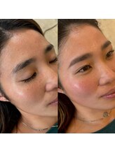 マナ ワクシング 海浜幕張(Mana waxing)/ツヤ肌wax/フェイシャルwax/幕張