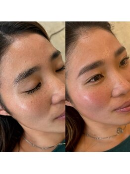 マナ ワクシング 海浜幕張(Mana waxing)/ツヤ肌wax/フェイシャルwax/幕張