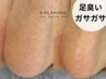 【残り5名】臭い足が無臭に。何度洗ってもニオイが取れない方こそ体験を