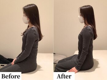 ソレア(Solea)/巻き肩改善1回目