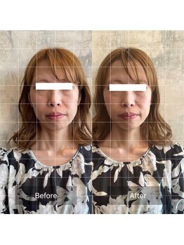 フフラ KANコルギセラピー山梨本店(fufla)/小顔ソムリエ　小顔