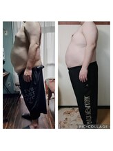 ラディアント(Radiant)/脅威の体感！！脂肪冷却！