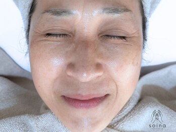 ソワナ(soina)の写真/《話題のヒト幹細胞ケア》ヒト幹細胞培養上清液を使用したピーリングや導入ケアで、若々しい印象に♪
