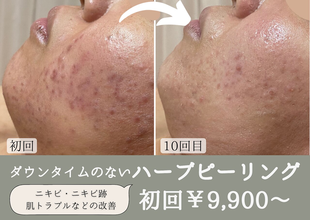 南郷7丁目駅でフェイシャルエステが人気のエステサロン