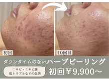 綺華(Ayaka)