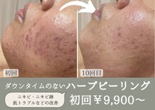 綺華(Ayaka)