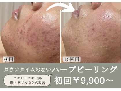 綺華(Ayaka)の写真