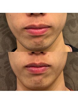 フェリーバ 流山店(FELIVA)/Before&After