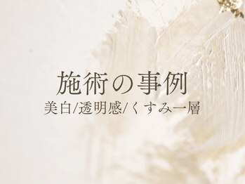 白雲木/施術の事例　美白/透明感/くすみ