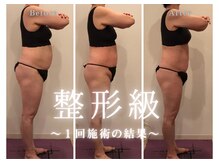 ミューゼルビューティー(MUSELLE BEAUTY)/