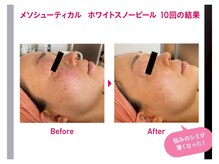 エヴェリーナ(Eveliiina)/ホワイトスノーピール