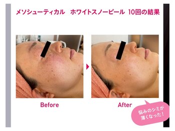 エヴェリーナ(Eveliiina)/ホワイトスノーピール