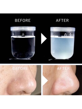 カナウ produced by きょうわ整体院(Kanau.)/ハイドロ毛穴洗浄