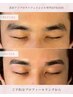 【美眉＆小鼻ケア♪】美眉アイブロウ+鼻単体ピーリング 30分 7,480円→