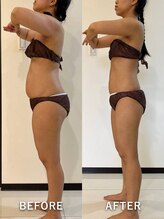 インディバサロン ド メイリィチィフゥア(indibasalon de meiliqihua)/産後ダイエットにもインディバ