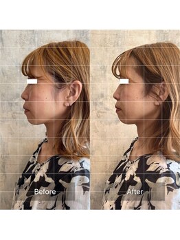 フフラ KANコルギセラピー山梨本店(fufla)/小顔ソムリエ　小顔