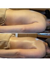 ルピナス(Lupinus)/背中のむくみとりませんか？