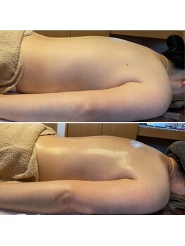 ルピナス(Lupinus)/背中のむくみとりませんか?