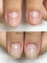 マリーロール 梅田店(Marie Laure)/自爪育成/深爪矯正/ネイルケア