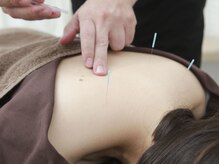 四日市あがた整体鍼灸院の雰囲気（【鍼×整体】首肩コリ/腰痛/慢性的な頑固な症状に！！）