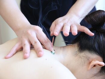 ユララ(YURARA)/肩こりには鍼灸施術をしましょう