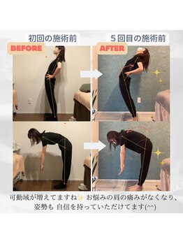 ラクリエ 姫路駅前院(La Creer)/前屈後屈ビフォーアフター