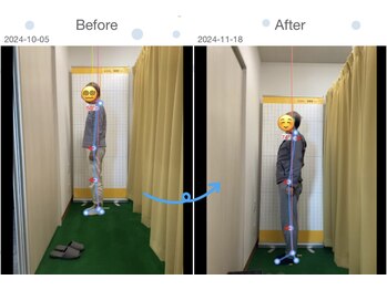 ひろがる接骨院 総社院/ビフォーアフター