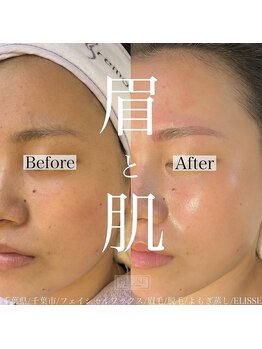 エリス(ELISSE)/眉とお肌も同時に綺麗を叶える