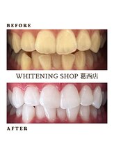 ホワイトニングショップ 葛西店/1番人気☆フリーパスコース