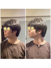 エクステンド鍼灸整体院(extend鍼灸整体院)/施術後　鍼