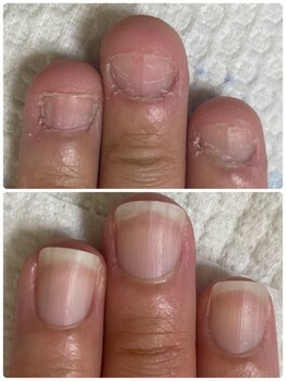グラティアラ 銀座の写真/爪のお悩み卒業へ♪[初回肌爪カウンセリング&爪を育てるハンドケア（爪の形整え、甘皮お手入れ）¥12100]