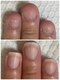 グラティアラ 銀座の写真/爪のお悩み卒業へ♪[初回肌爪カウンセリング&爪を育てるハンドケア（爪の形整え、甘皮お手入れ）¥12100]