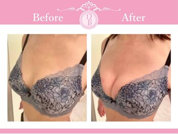 デミーナ(Demyna)/