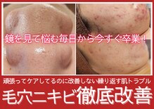 ユウビジン(YOU美人)