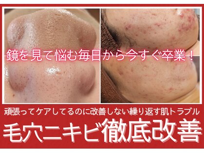ユウビジン(YOU美人)の写真