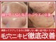 ユウビジン(YOU美人)の写真