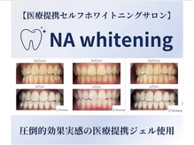 NAホワイトニング 自由が丘店