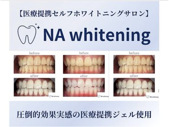 NAホワイトニング 自由が丘店の写真/月額プランで通いやすく、続けやすい♪セルフホワイトニングで理想の歯の白さを毎月キープ！