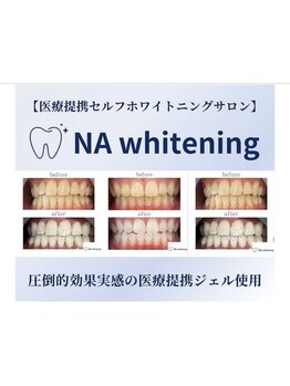 定額/月額メニューのあるサロン